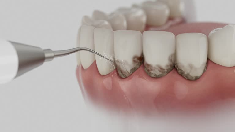 Trusted Teeth Cleaning And Checkup service in Pond Creek, OK - Dentist Open Now